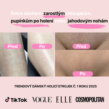 Holící strojek Silka™ 2.0